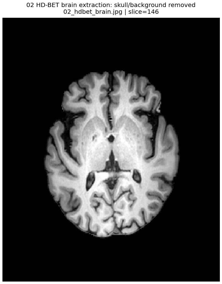 HD-BET brain-only image