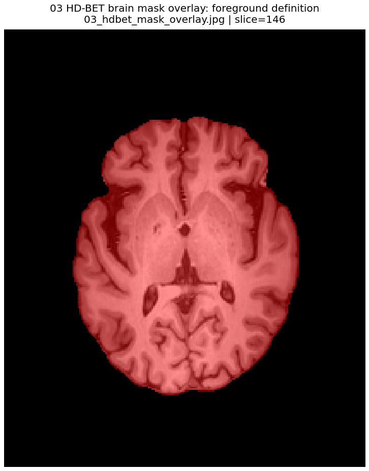 HD-BET brain mask overlay