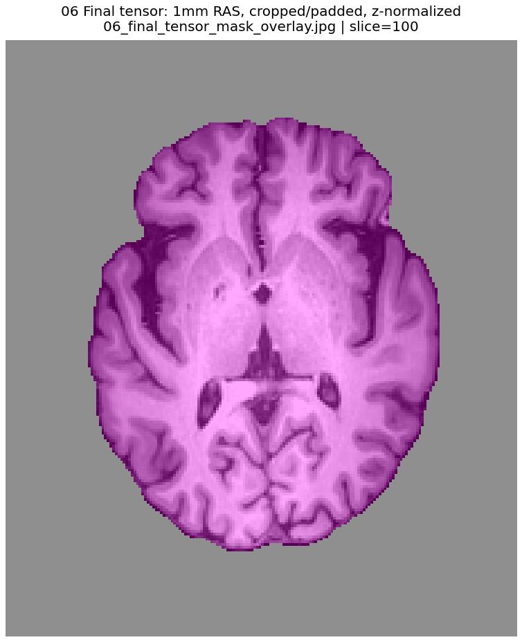 Final tensor and brain mask overlay