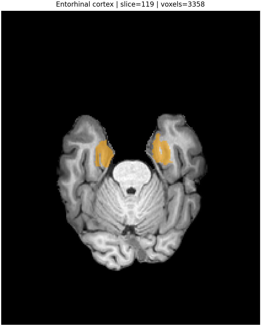 Entorhinal cortex overlay